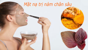 Mat na tri nam chan sau